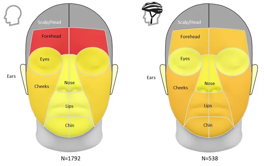 facial_fractures