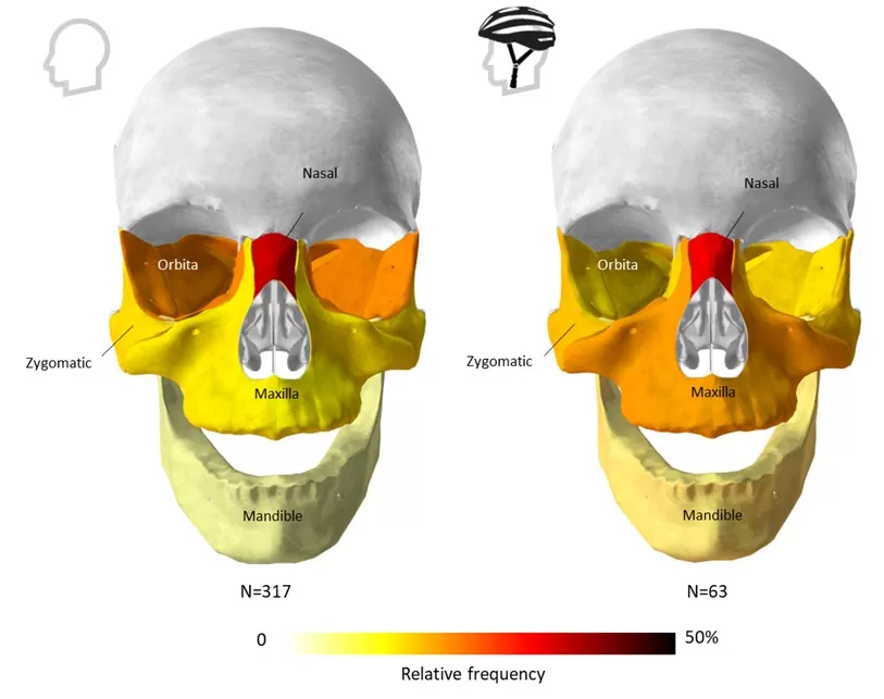 Bicycle helmets are getting better, but can’t we do more?